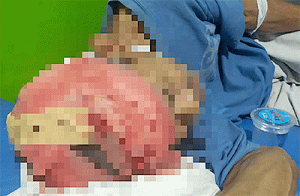 Gegara Masalah Sepele, Seorang Anak Tega Bacok Ayah Kandung