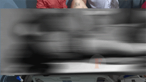 Kedua Tangan Seorang Tukang Ojek Putus Ditebas Sajam