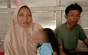 Orang Tua Kurang Mampu, Pengobatan Anak Penderita Otak Mengecil di Tubaba Terhenti