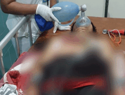 Polisi Selidiki Kasus Dugaan Bunuh Diri Seorang Pria Paruh Baya di Waena