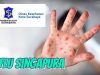 Dinkes Surabaya Himbau Agar Masyarakat Tidak Panik Terhadap Flu Singapura