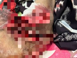 Kepala Desa Air Solok Aniaya Warganya Nyaris Putus Tangan dan Kaki