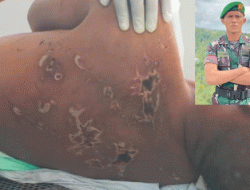 Jejak Luka di Barak Komando, Kematian Prada Lucky Mulai Terungkap, Empat Prajurit Ditahan